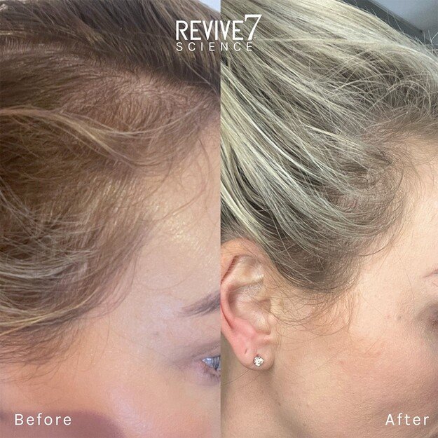 Revive7 - Hair Treatment 30 ml